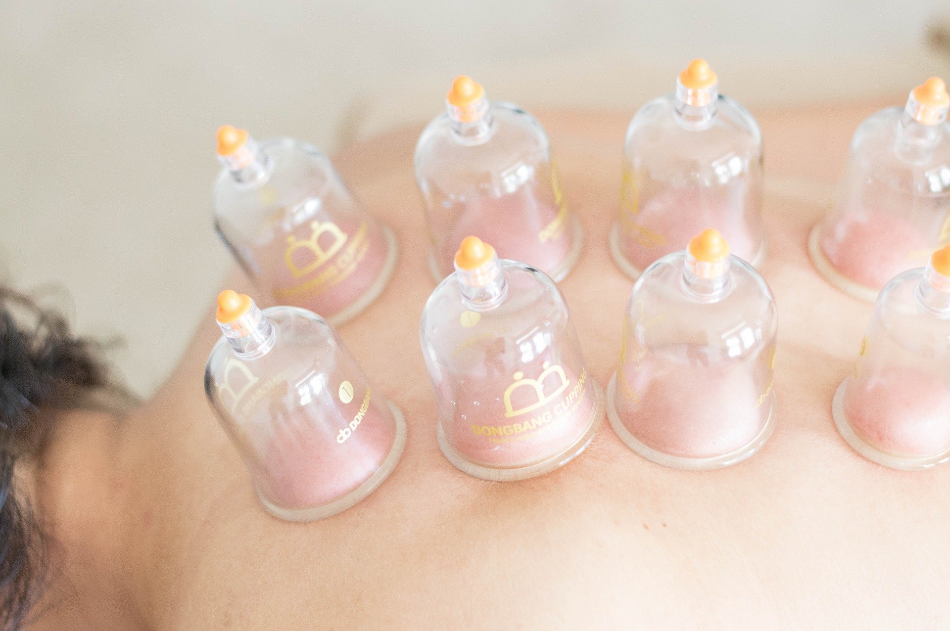 massage-cupping-therapy
